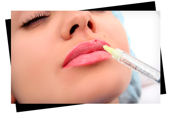Woman getting lip injections